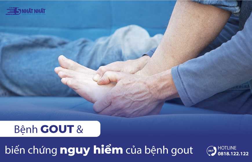Bệnh Gout và những biến chứng nguy hiểm của bệnh Gout