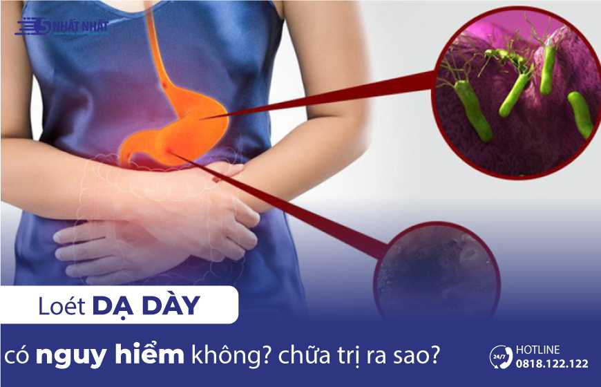 Loét dạ dày có nguy hiểm không? Chữa trị loét dạ dày như thế nào?