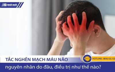 Tắc mạch máu não: Nguyên nhân, dấu hiệu, biến chứng nguy hiểm cần biết