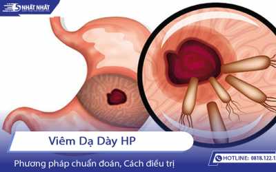 Viêm dạ dày HP là gì? Điều trị và Phòng ngừa thế nào?