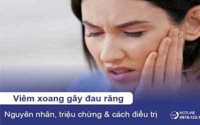 Viêm xoang gây đau răng: Nguyên nhân và cách điều trị