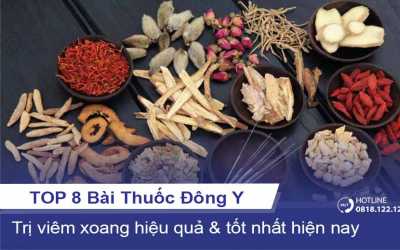 8 bài thuốc Đông y trị viêm xoang tốt hiện nay