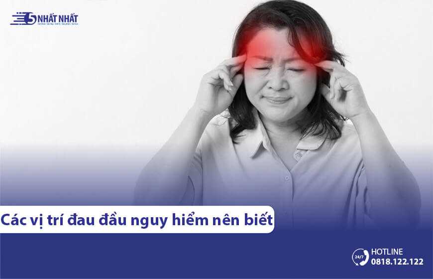 Cảnh giác với 7+ vị trí đau đầu nguy hiểm | Kèm nguyên nhân