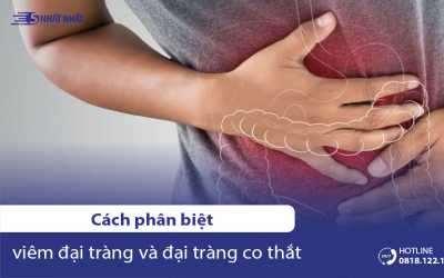 Cách phân biệt viêm đại tràng và đại tràng co thắt