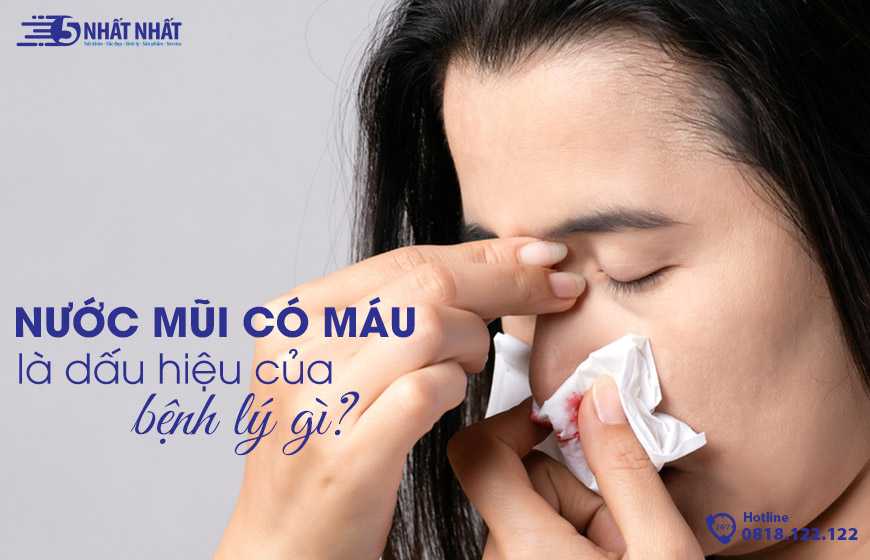 Nước mũi có máu có nguy hiểm không? Cách chữa trị