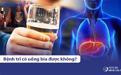 Giải đáp thắc mắc: Bệnh trĩ có uống bia rượu được không?