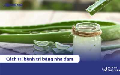 10 Cách chữa bệnh trĩ bằng nha đam hiệu quả, dễ thực hiện