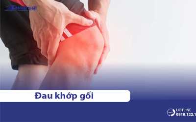 Đau khớp đầu gối là bệnh gì? Nguyên nhân, triệu chứng & chẩn đoán