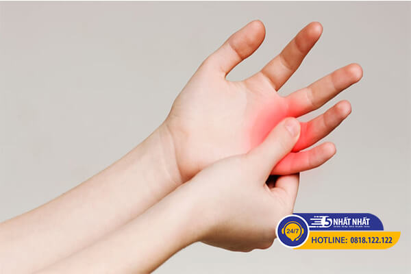 Sưng phù, ngứa ở ngón tay là biểu hiện của bệnh viêm khớp ngón tay