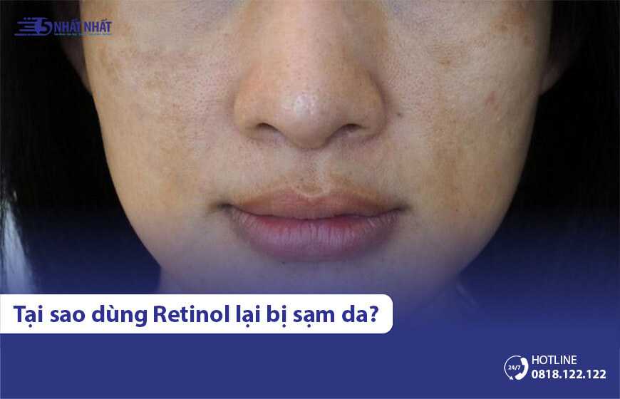 Tại sao dùng Retinol bị sạm da? Bao lâu thì hết? Xử lý thế nào?