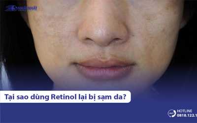 Tại sao dùng Retinol bị sạm da? Bao lâu thì hết? Xử lý thế nào?