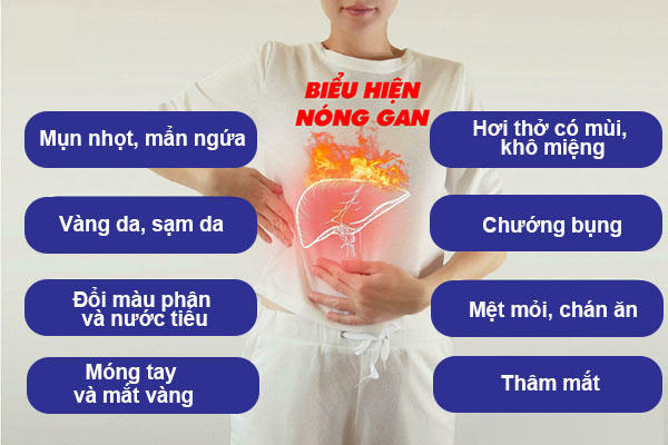 biểu hiện nóng gan bạn không nên bỏ qua