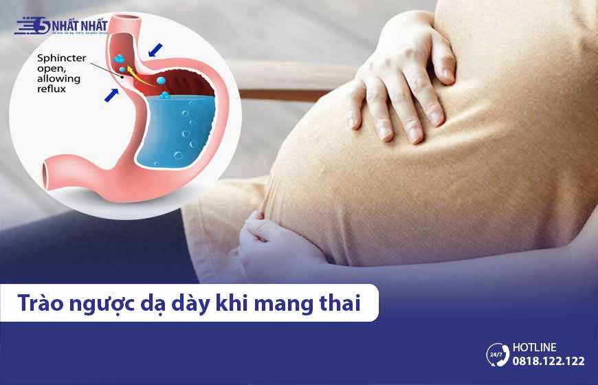 Cách xử lý trào ngược dạ dày thực quản ở phụ nữ mang thai
