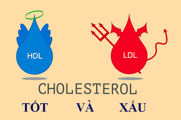 rối loạn mỡ máu