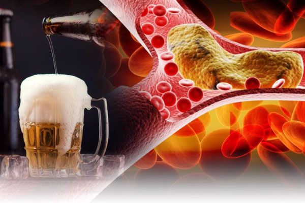 Uống rượu bia nhiều là nguyên nhân dẫn đến mỡ máu tăng cao