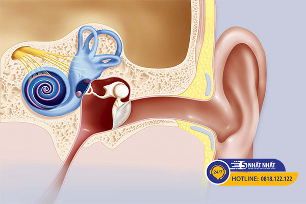 Bệnh meniere gây nhức đầu kèm ù tai