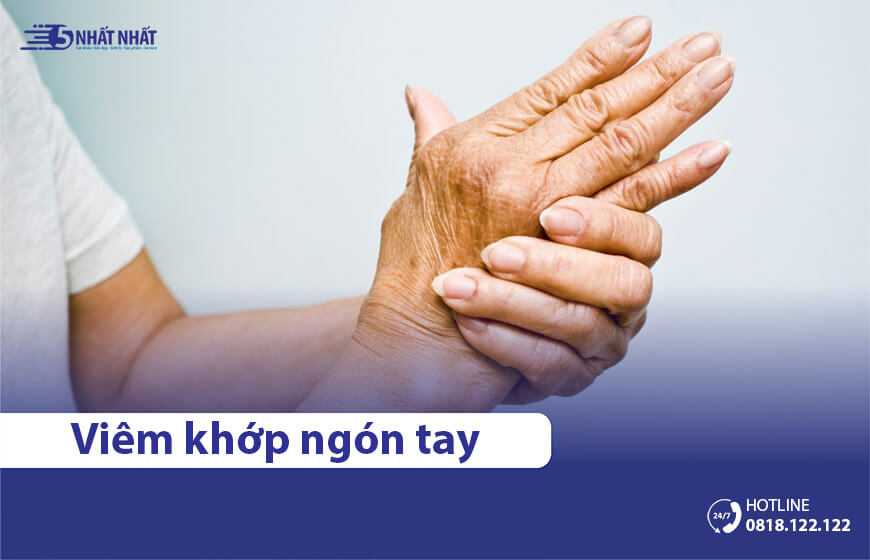 Viêm khớp ngón tay gây đau nhức: Nguyên nhân và cách điều trị