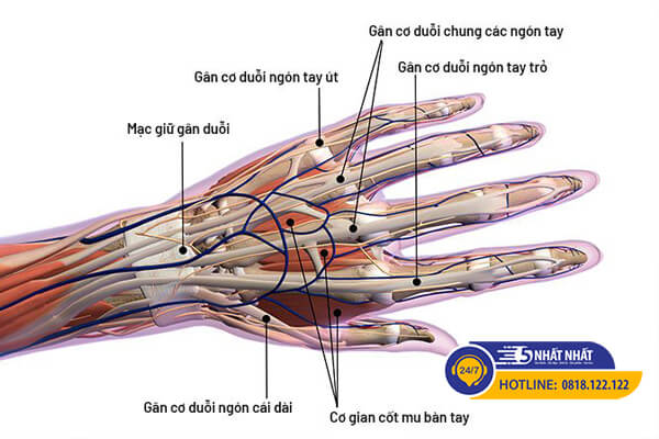 rối loạn mô cơ xương gây đau cổ tay