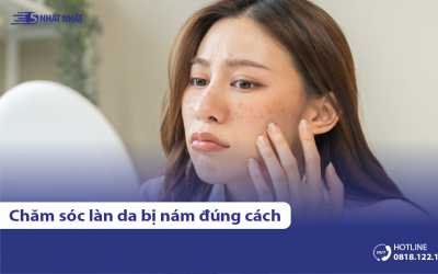 Quy trình chăm sóc da bị nám đúng cách & những lưu ý khi thực hiện