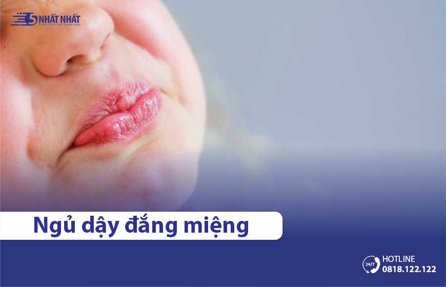 Sáng ngủ dậy miệng đắng là bệnh gì? 3 Cách chữa hiệu quả, an toàn