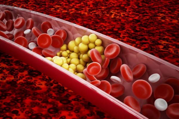 Nhịn ăn thải độc tác dụng giảm Cholesterol xấu trong máu