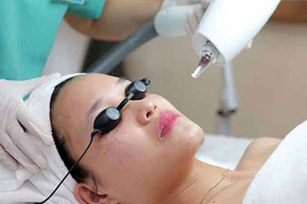 Chữa nám nội tiết bằng tia laser