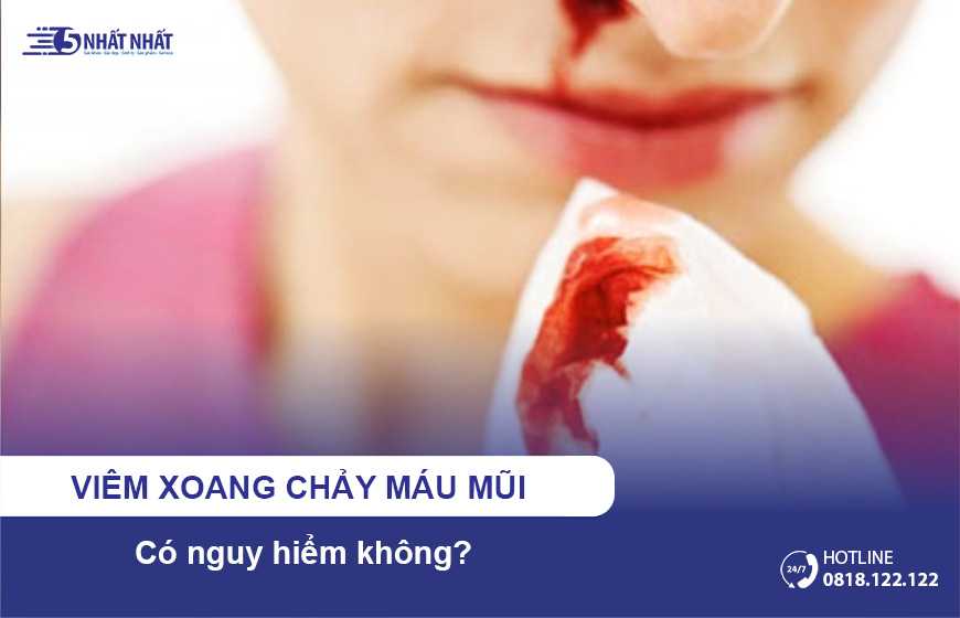 Viêm xoang chảy máu mũi có nguy hiểm không?