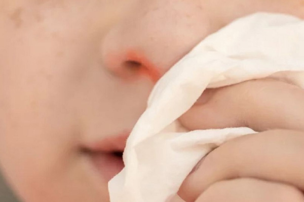 Khô mũi khiến niêm mạc lòng mũi bị kích ứng gây ngứa mũi 