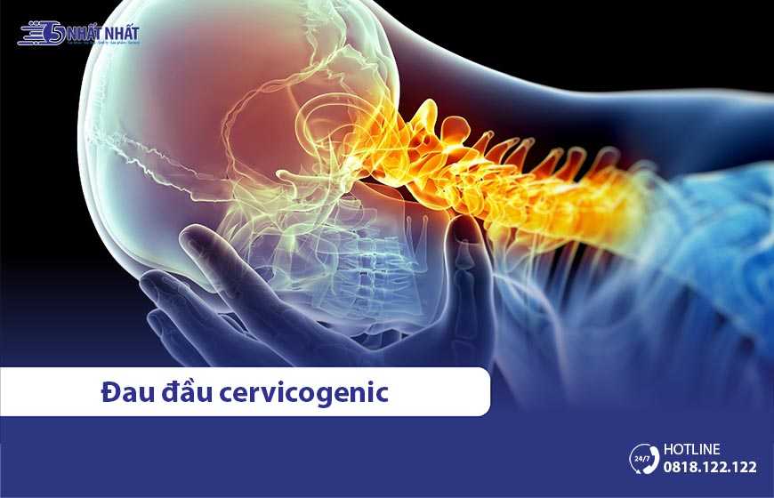 Đau đầu Cervicogenic là gì? Nguyên nhân, triệu chứng & cách điều trị