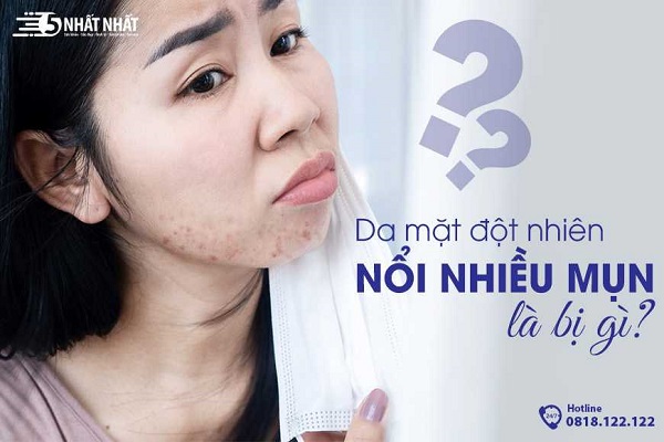 da mặt đột nhiên nổi nhiều mụn