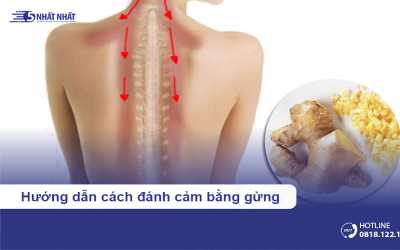 Hướng dẫn cách đánh cảm bằng gừng đơn giản, hiệu quả