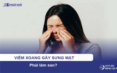 Viêm xoang gây sưng mặt, phải làm sao?