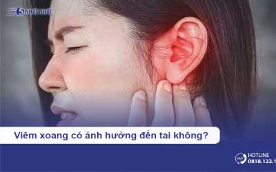 Viêm xoang có ảnh hưởng đến tai không?