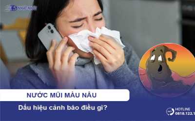 Nước mũi màu nâu là dấu hiệu cảnh báo điều gì?