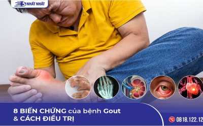 8 Biến chứng của bệnh Gout & Cách điều trị