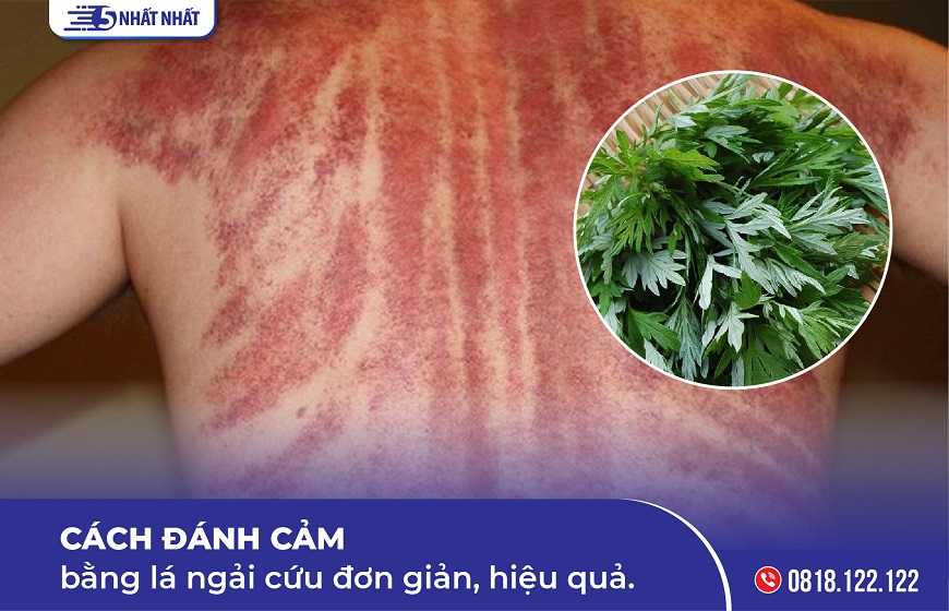 Hướng dẫn đánh cảm bằng lá ngải cứu đơn giản, hiệu quả