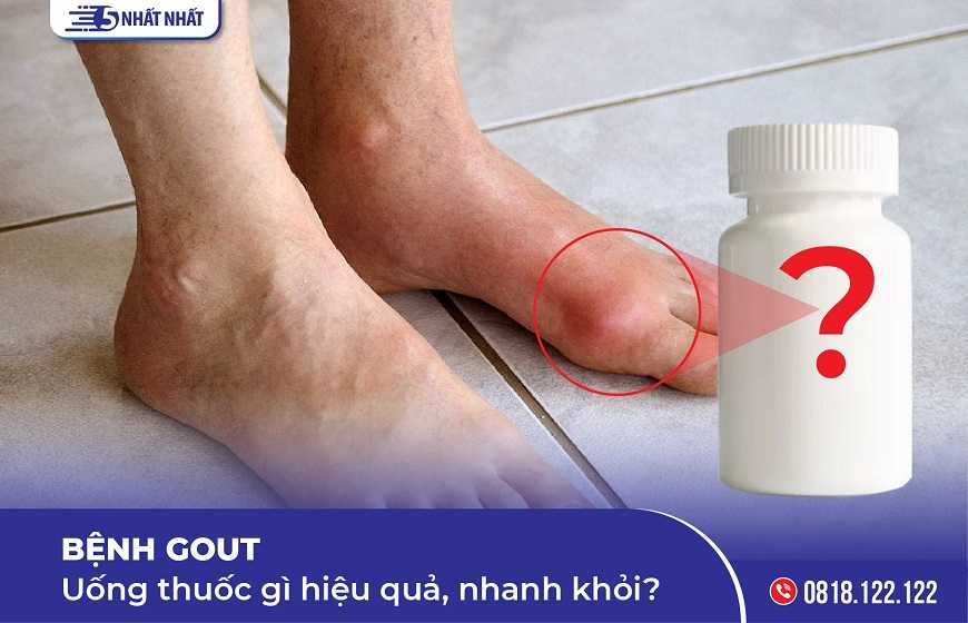 Bệnh gout uống thuốc gì hiệu quả, nhanh khỏi?