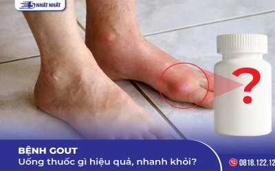 Bệnh gout uống thuốc gì hiệu quả, nhanh khỏi?