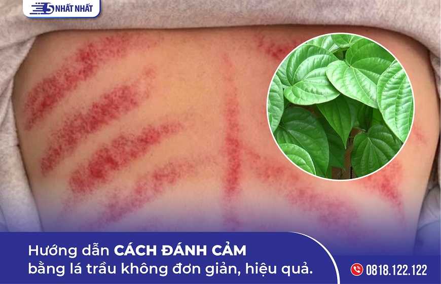 Hướng dẫn cách đánh cảm bằng lá trầu không