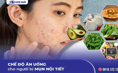 Chế độ ăn uống cho người bị mụn nội tiết từ tư vấn của chuyên gia