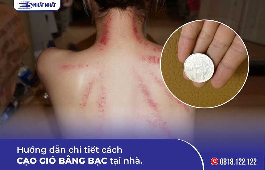 Hướng dẫn chi tiết cách cạo gió bằng bạc tại nhà