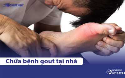 7 cách chữa bệnh gout dân gian tại nhà hiệu quả, dễ thực hiện