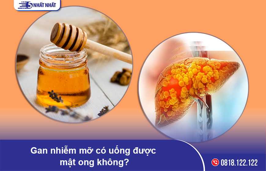 Gan nhiễm mỡ có uống được mật ong không?