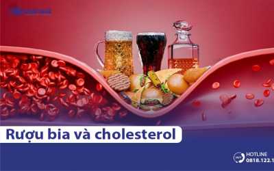 Rượu bia ảnh hưởng tới mức cholesterol như thế nào?