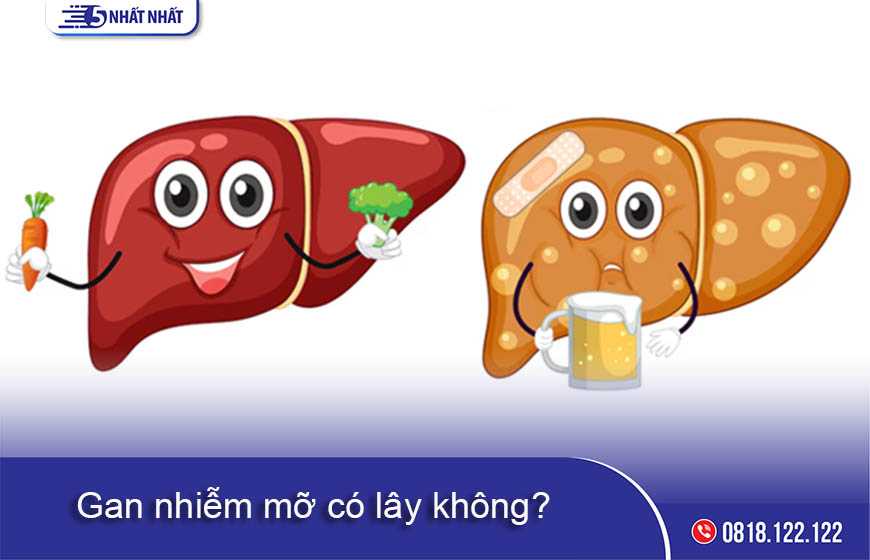 Gan nhiễm mỡ có lây không?