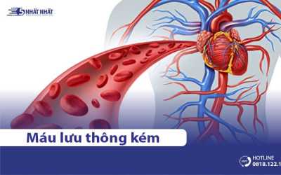 Nguyên nhân khiến khí huyết (máu) lưu thông kém & Cách điều trị